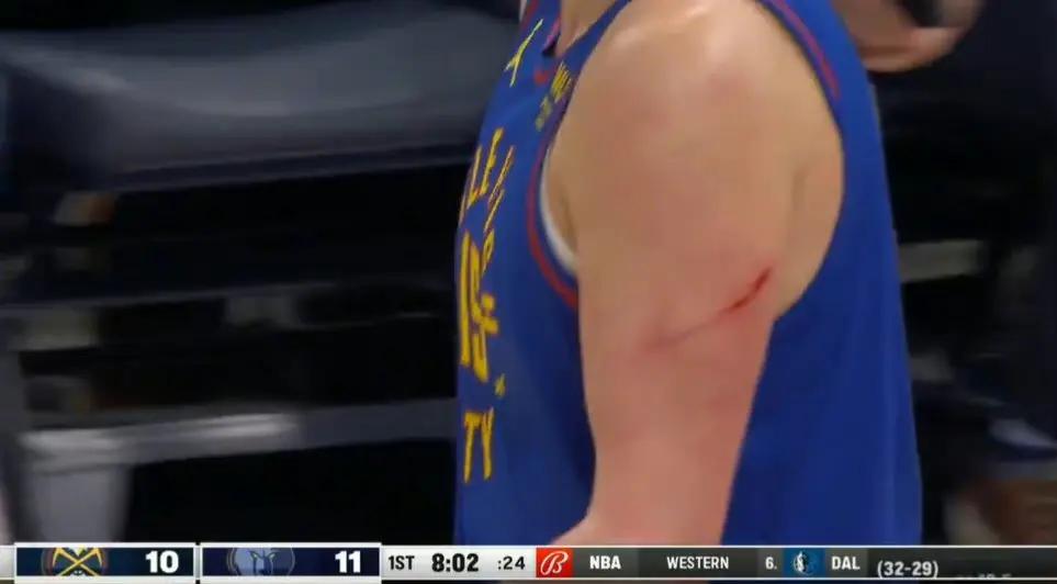 关于灰熊队队员受伤,球队备战备战增加难度的信息 关于灰熊队队员受伤,球队备战备战增加难度的信息