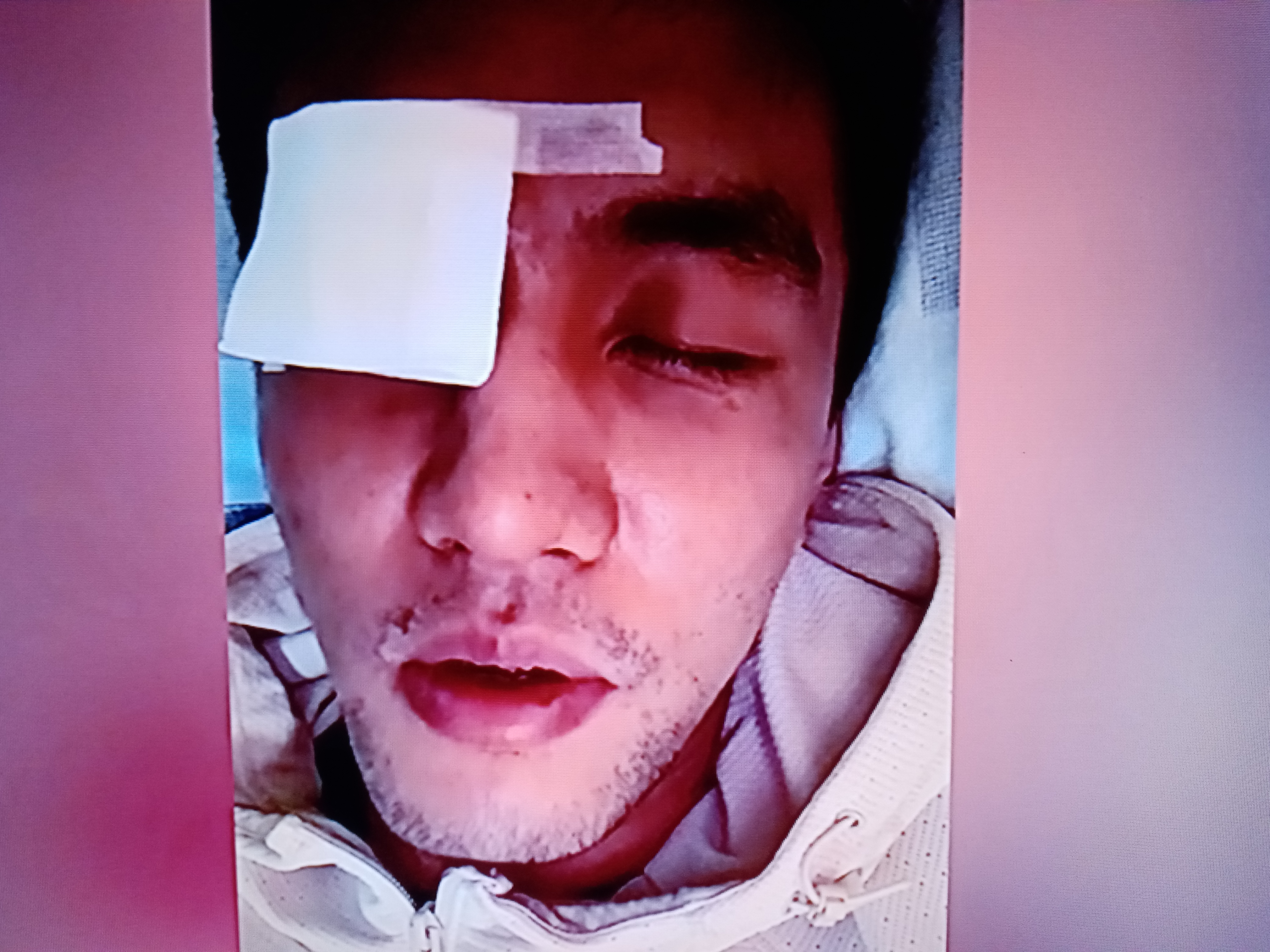 FB体育网页版-公牛队球员接受手术治疗伤病的简单介绍